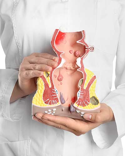 Hemorrhoids Treatment Specialist Near Me in Melville NY, New Hyde Park NY, Forest Hills NY, Jericho NY, Mineola NY, Lake Success NY, Babylon NY, Massapequa NY, East Setauket NY and Riverhead NY